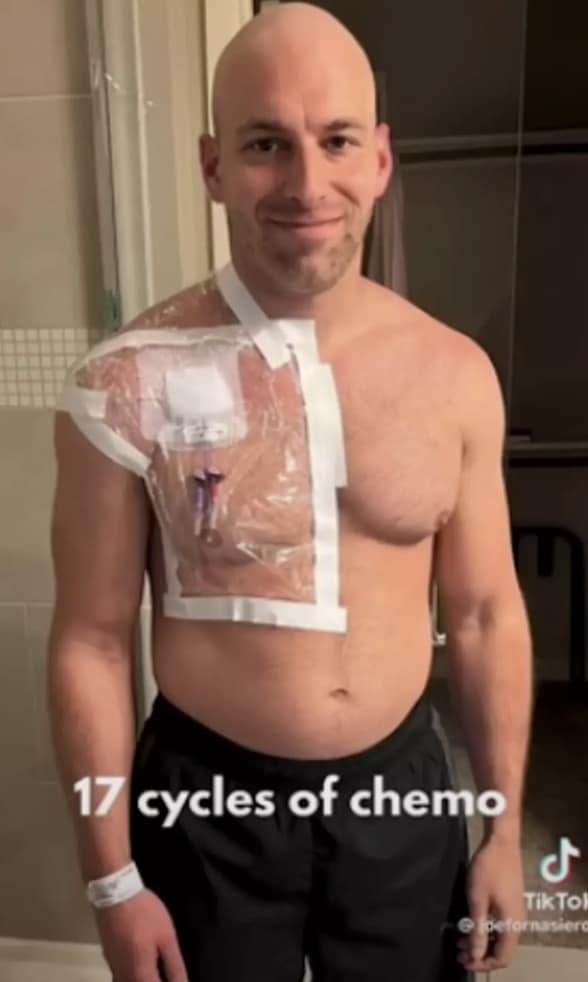 Entusiasta fitness revela primeiros sintomas que levaram ao diagnóstico de câncer apesar do estilo de vida saudável Ele passou por duas grandes cirurgias de 10 horas cada (The Patient Story/YouTube)