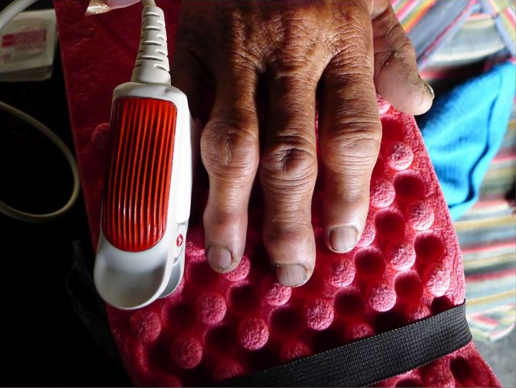 Os métodos de medição da concentração de hemoglobina e saturação de oxigênio no sangue foram não invasivos na pesquisa (Imagem: Sienna R. Craig)