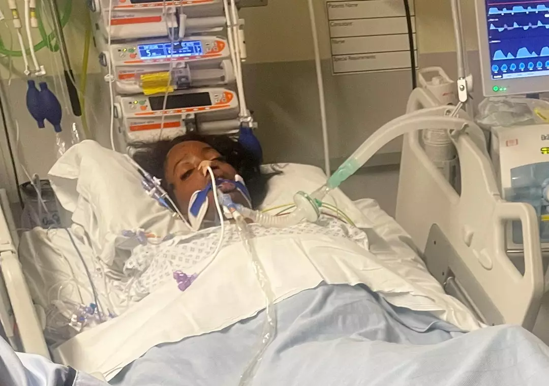 Adolescente tem pernas e dedos amputados após pensar que doença grave era apenas gripe A estudante universitária contraiu uma condição com risco de vida, que levou a várias amputações (SWNS)