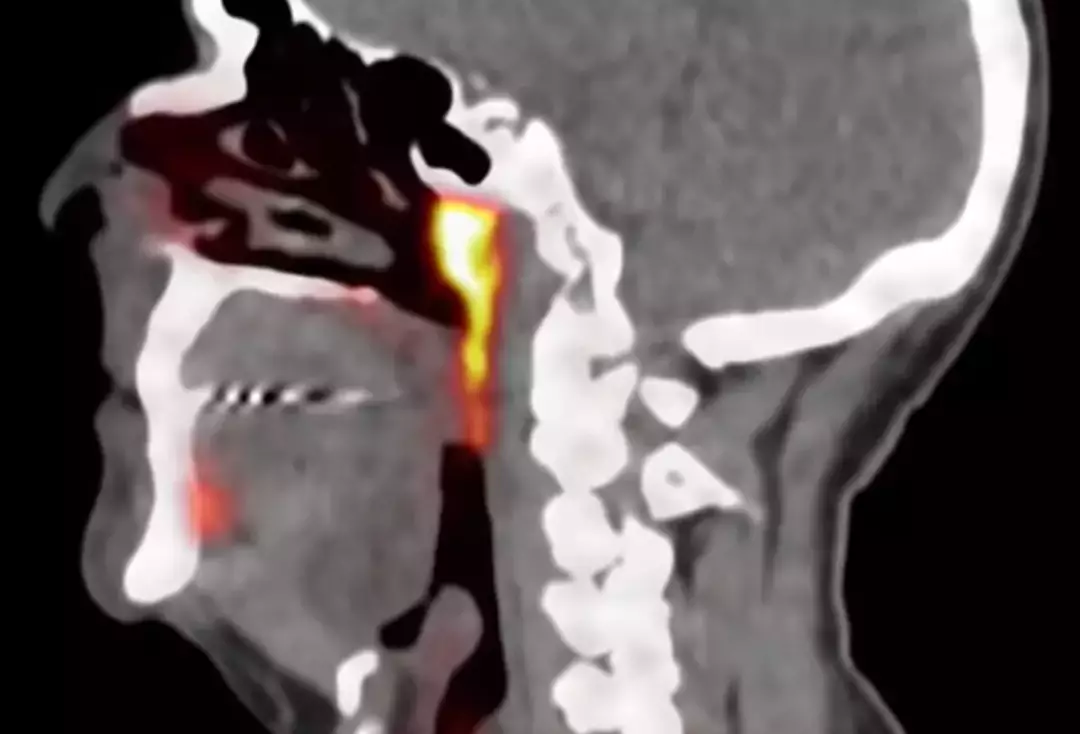 Cientistas descobriram por acidente um novo órgão no corpo humano Ele foi descoberto por meio de exames “sensíveis” (YouTube/Antoni Van Leeuwenhoek)