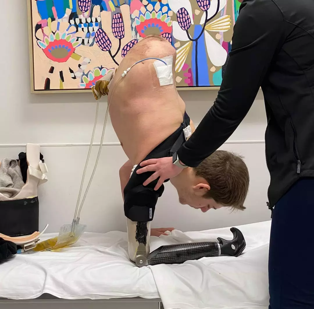 Jovem cortado ao meio por empilhadeira compartilha foto horrível da cena do acidente Loren Schauers sofreu um terrível acidente com empilhadeira em 2019 (Instagram/@loren.schauers)