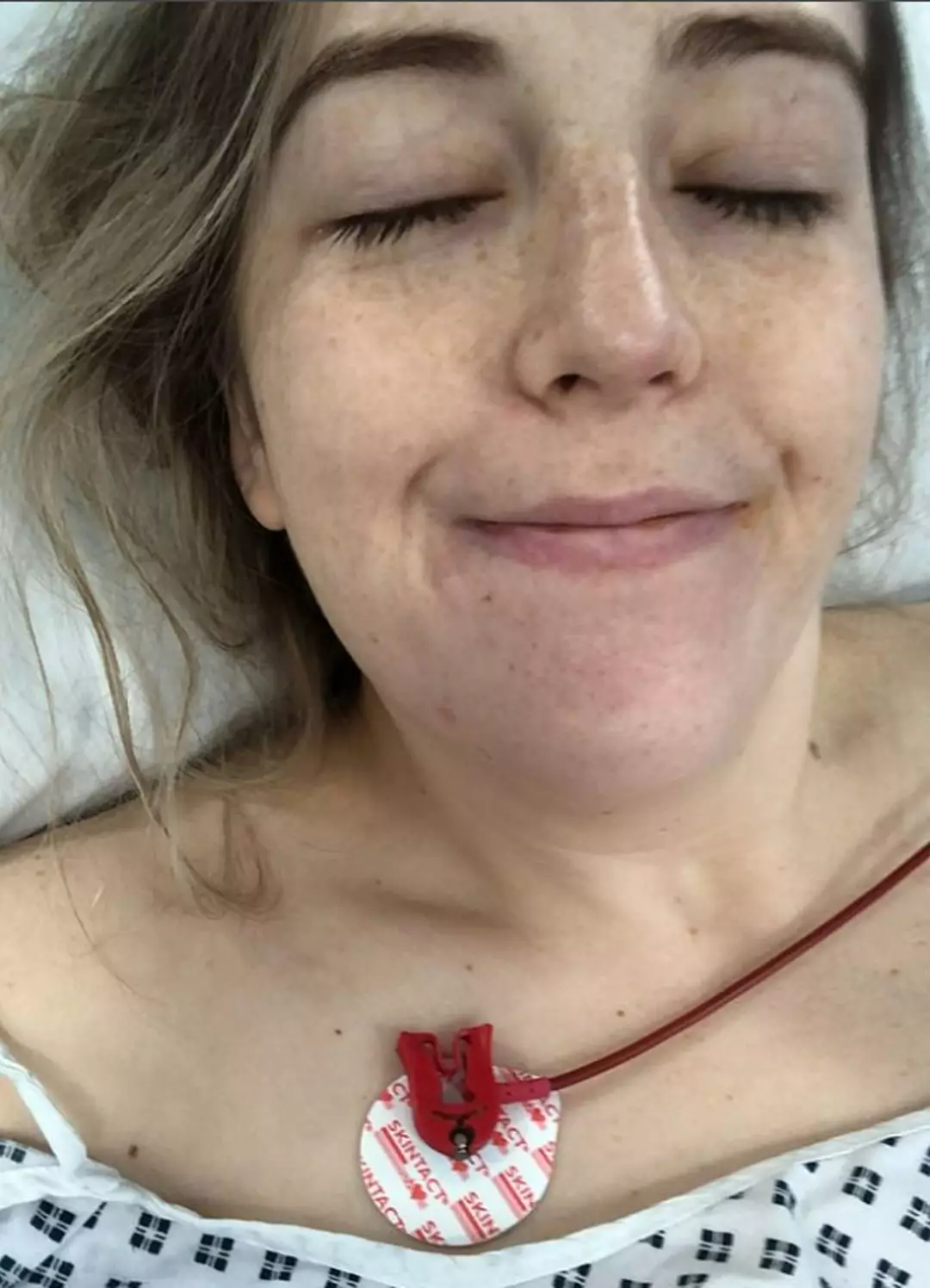 Mulher de 23 anos faz alerta após hábito de estalar o pescoço romper uma artéria principal e deixá-la paralisada A paramédica vem reconstruindo sua vida após o derrame chocante (Kennedy News and Media)