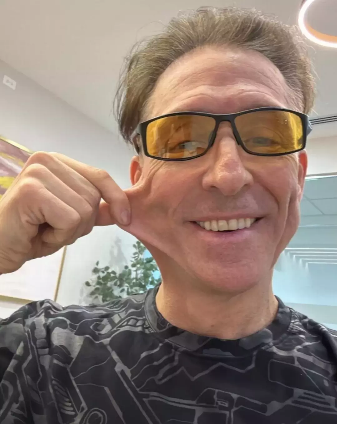 Homem injeta células das nádegas no rosto em busca de "viver para sempre" Aos 51 anos, Dave Asprey é conhecido como o “Pai do Biohacking” (Dave Asprey/Facebook)