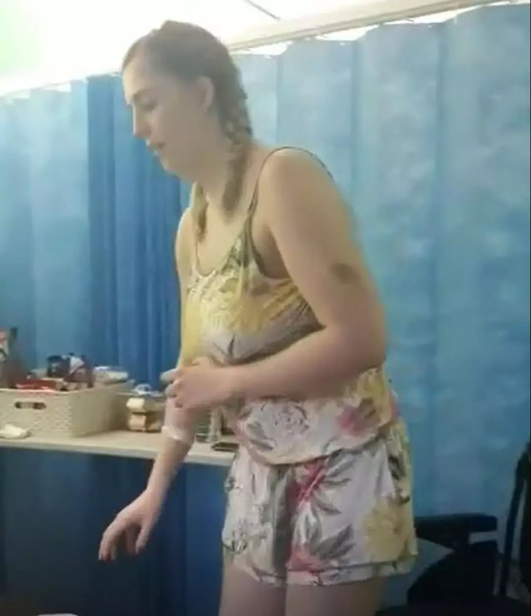 Mulher de 23 anos faz alerta após hábito de estalar o pescoço romper uma artéria principal e deixá-la paralisada O hábito rotineiro de estalar o pescoço de Natalie Kunicki se transformou em um pesadelo médico (Kennedy News and Media)