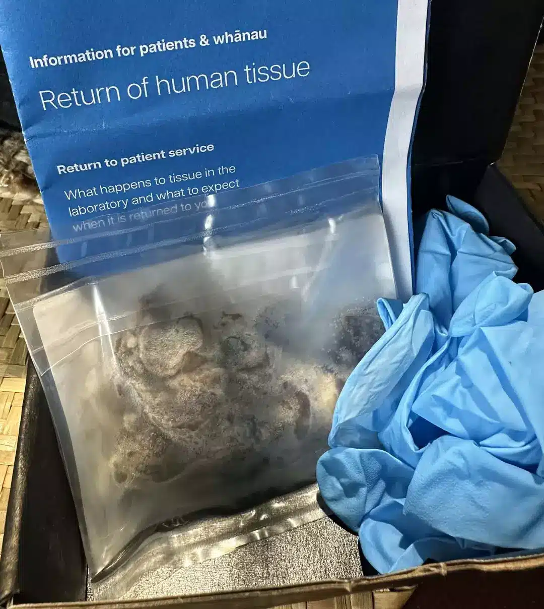 A família pretende enterrá-lo (Kennedy News and Media)