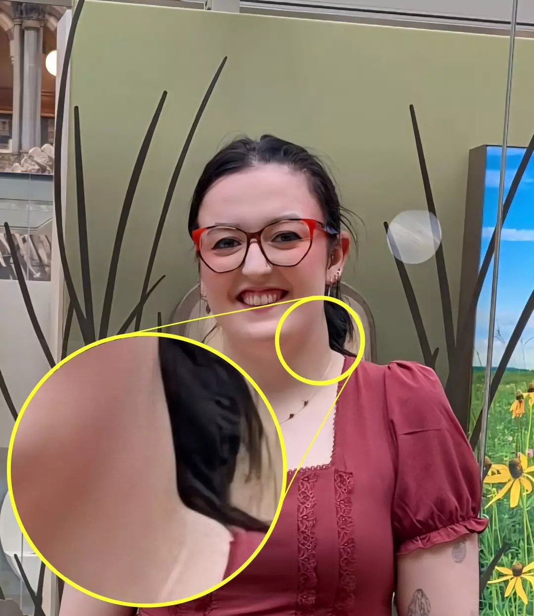 Maia precisou passar por diferentes tipos de quimioterapia (Kennedy News and Media)