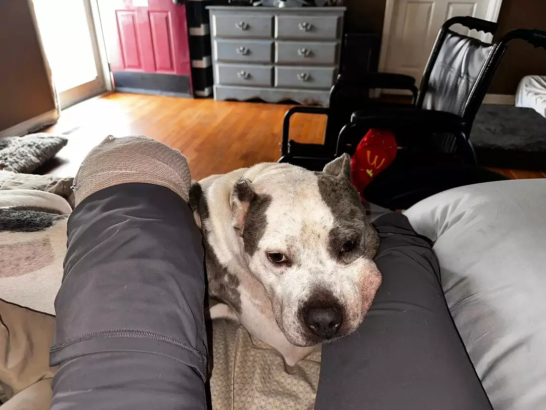 Amanda com Ralphie após o ataque de Dennis (Facebook/Amanda Mea)