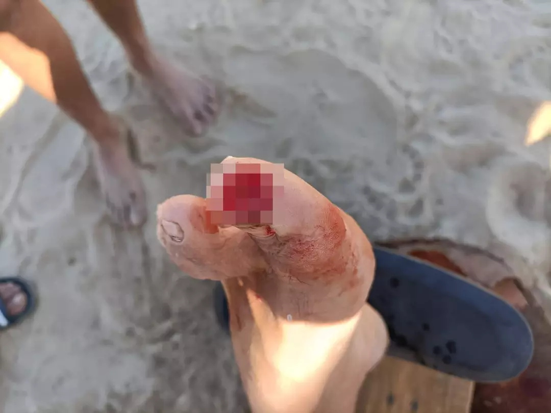 Especialistas alertaram que o clima mais quente aumenta a probabilidade de ataques de piranhas (CEN)