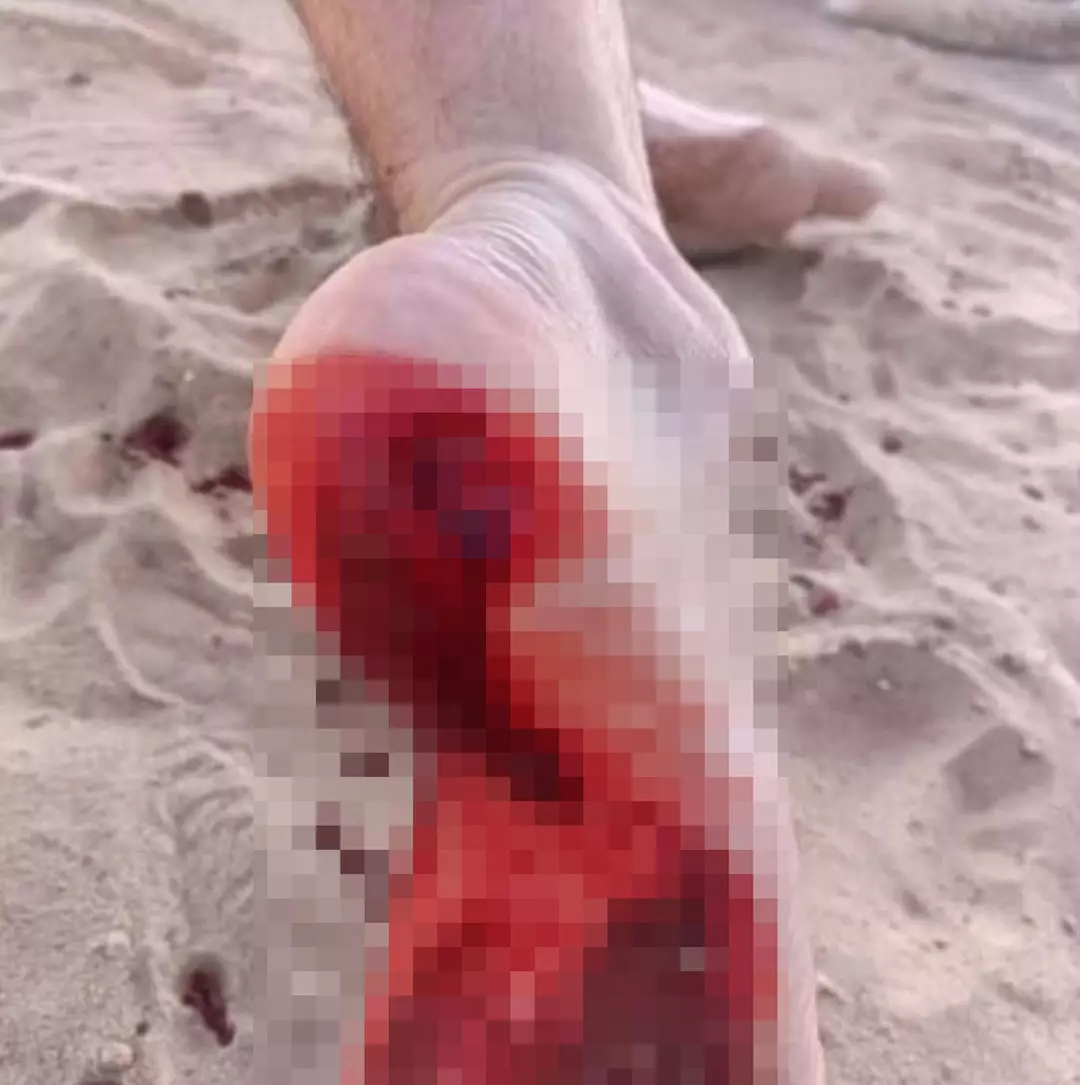 Os salva-vidas fecharam a praia e hastearam uma bandeira vermelha de aviso (CEN).