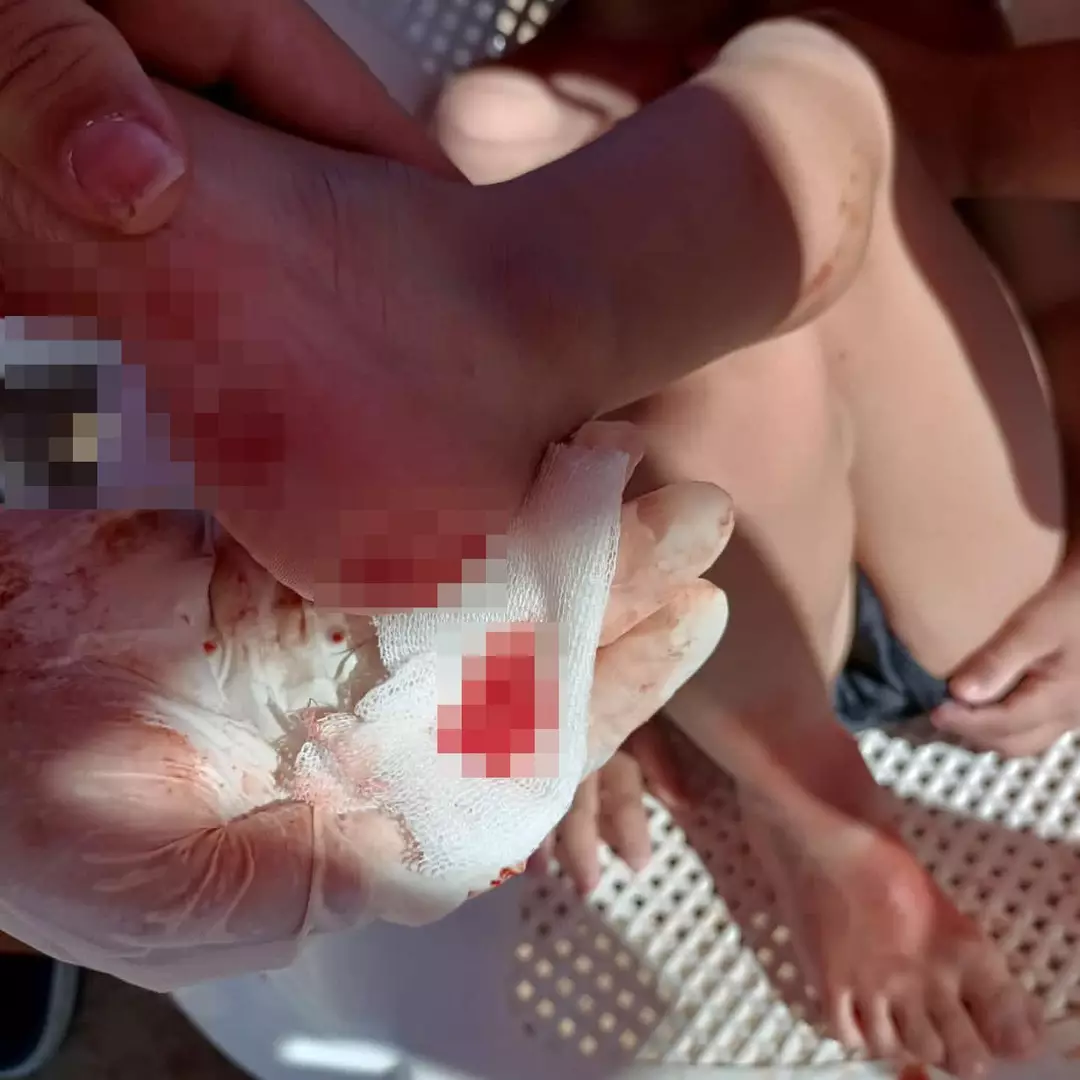 Um hospital próximo informou ter atendido pessoas que entraram no rio em trechos onde o banho é proibido (CEN).