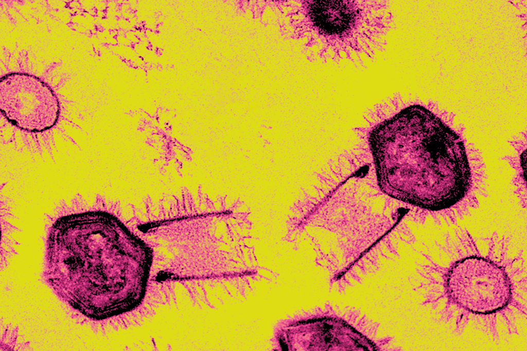 Imagem microscópica do vírus Tupanvirus.