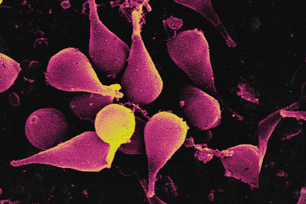 Imagem microscópica do vírus Naiavirus.